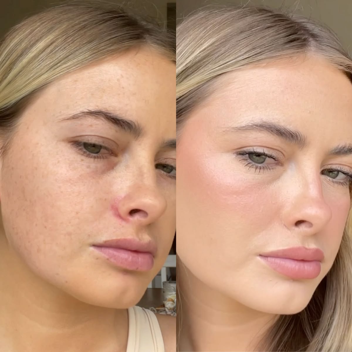 Medicube Peel Shot : Le reset coréen qui déloge toutes les impuretés.
