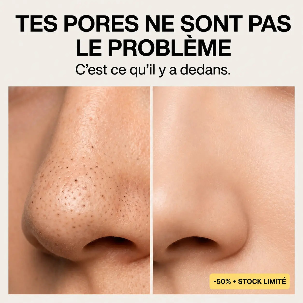 Medicube Peel Shot : Le reset coréen qui déloge toutes les impuretés.