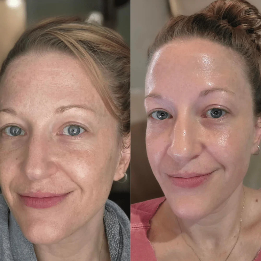 Medicube Peel Shot : Le reset coréen qui déloge toutes les impuretés.